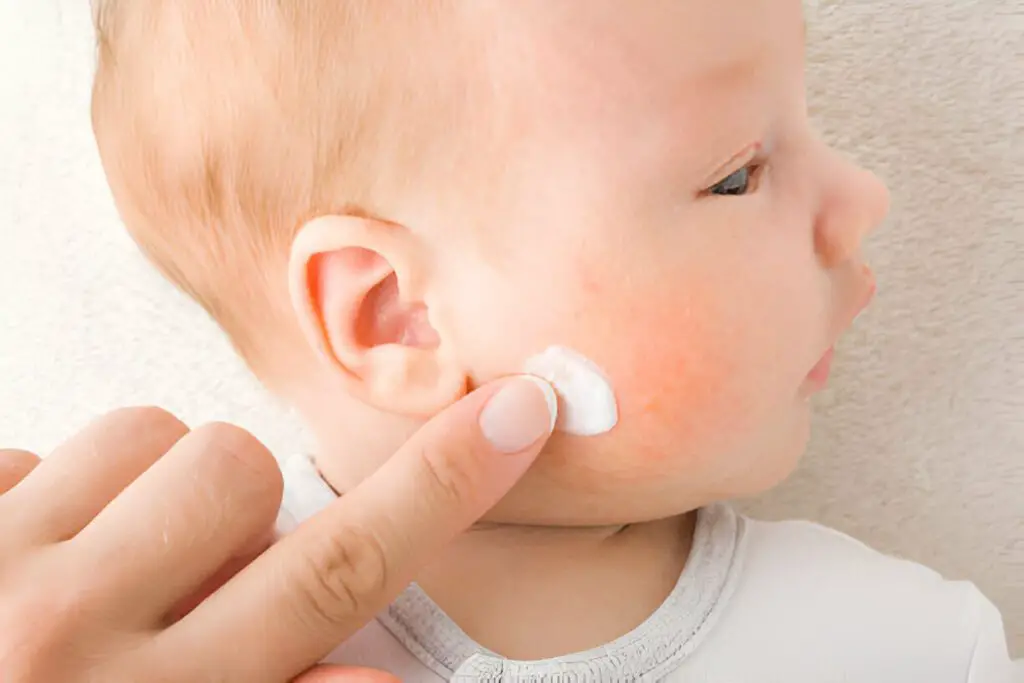 Tratamiento de la alergia primaveral en bebés